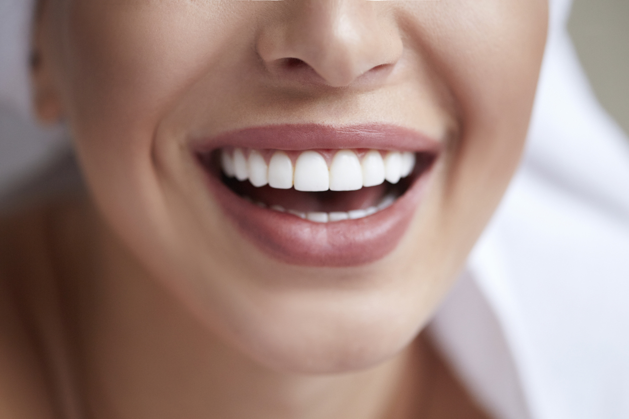 Do veneers really give you the perfect smile?