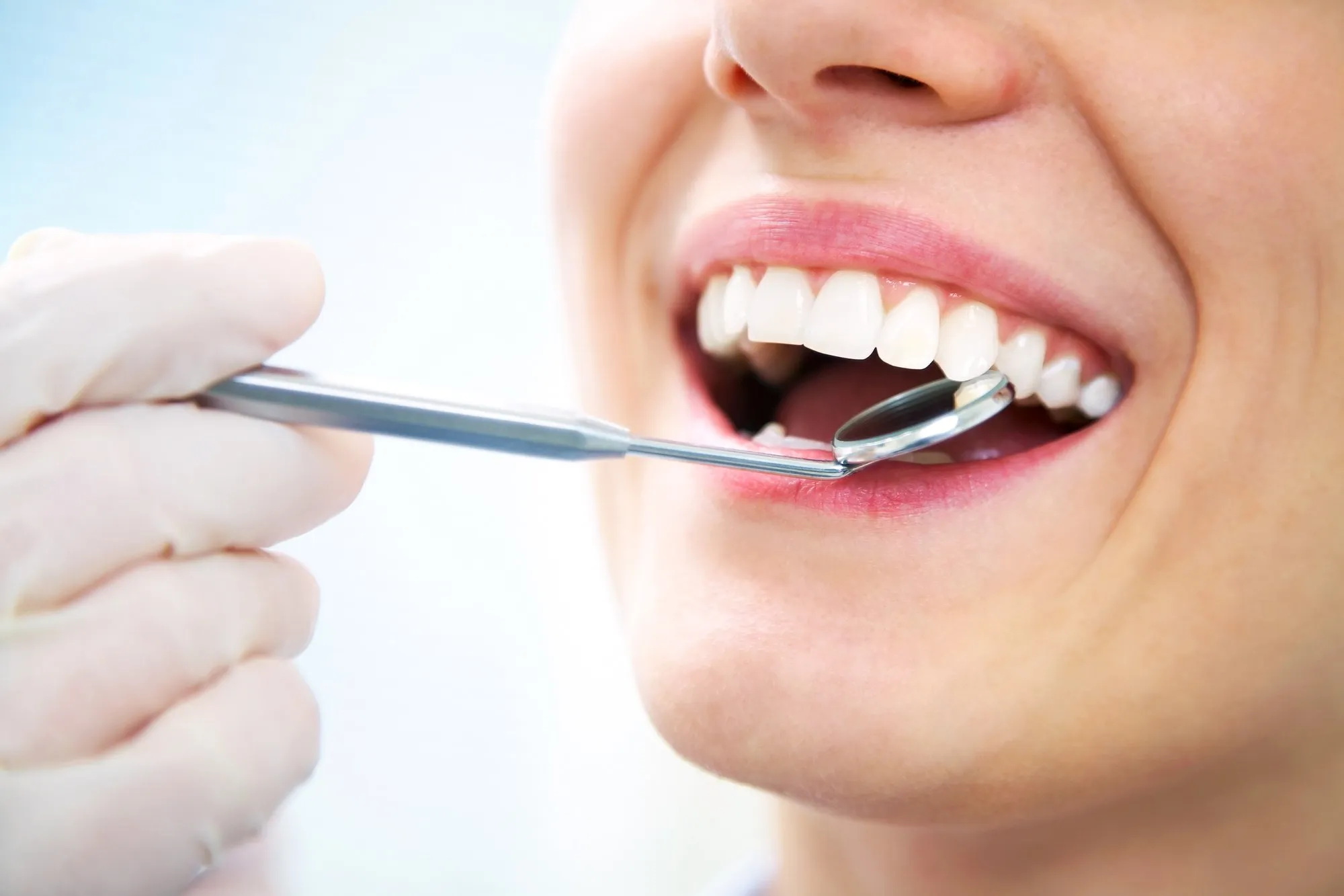 The Art and Science of Teeth Whitening in Rochdale